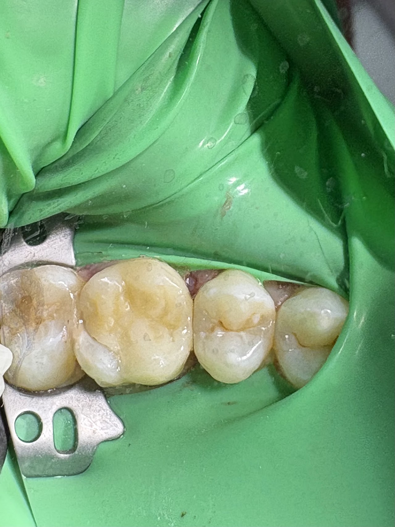 Trabajo odontológico en proceso